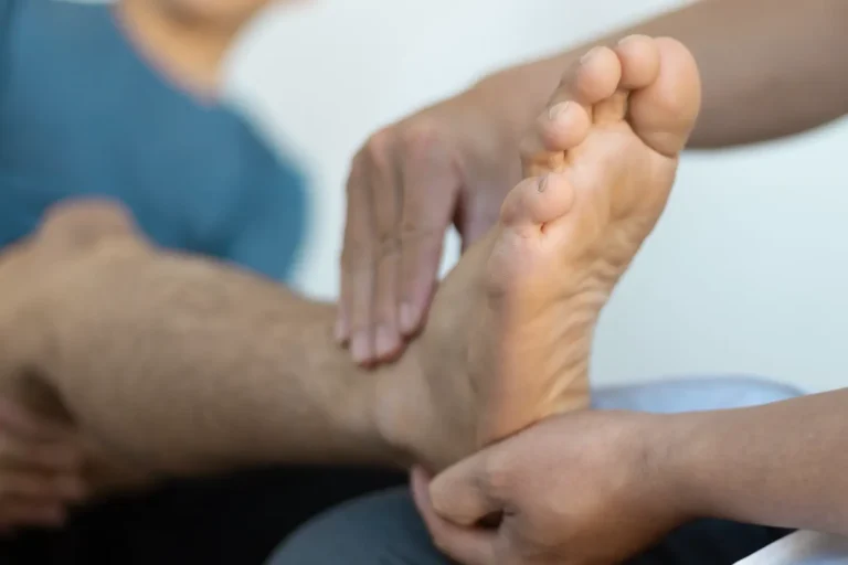  5 Tips to Manage Bunion Pain at Home