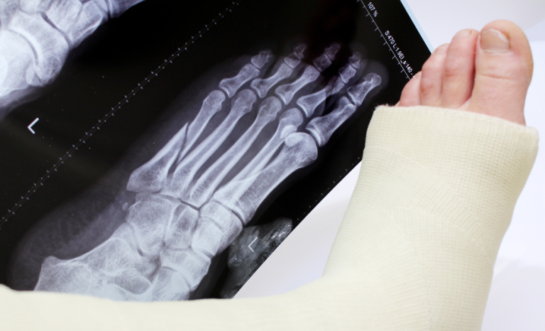 Is It Broken? A Podiatrist’s Checklist